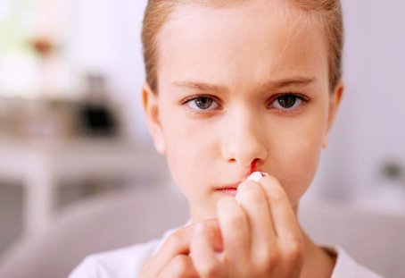 Носовое кровотечение у ребенка: причины и первая помощь